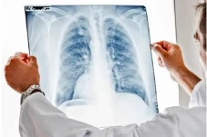 Pneumonia Lebih Rentan...