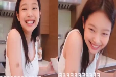 Memar di Tangan Jennie...