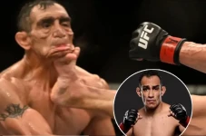Petarung UFC Wajahnya...