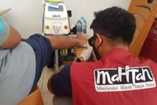 Program Hapus Tato di...