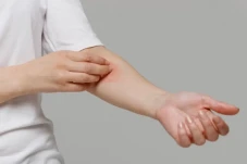 10 Cara Alami Mengatasi...