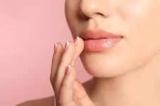 5 Cara Mencegah Bibir...