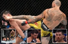 Hidung Petarung UFC...