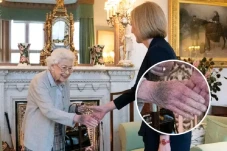 Tangan Memar Ratu Elizabeth...
