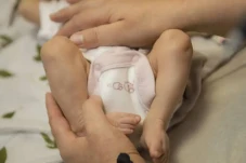 Gejala Hernia pada Bayi...