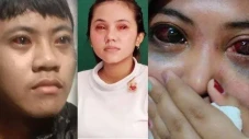 Rekam Medis Beda Mata...