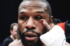 Mata Mayweather Lebam...