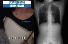 Viral! Wanita Ini Tulang...