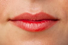 6 Tips Atasi Bibir Pecah-Pecah...