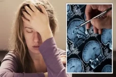 5 Cara Meringankan Migrain...