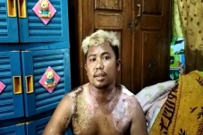 Korban Penyiraman Air...