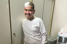 Indra Bekti Jalani Operasi...