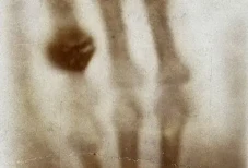 Tragedi Wilhelm Röntgen,...
