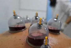 Benarkah Bekam Membatalkan...