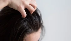5 Penyebab Rambut Gatal...
