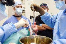 Ahli Bedah Kembali Lakukan...