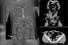 Kejadian Langka, Testis...
