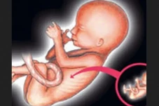 Mengenal Fetus in Fetu,...