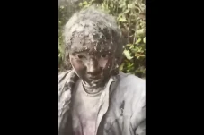 Kondisi Pilu Zhafirah,...
