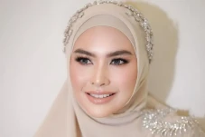 Alami Wajah Penuh Luka,...
