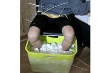 Pria Ini Amputasi Sendiri...