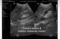 Kisah Pilu Wanita Idap...