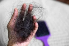 Rambut Rontok Berlebih...