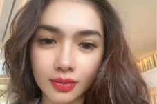Punya Wajah Baru Pascaoperasi...