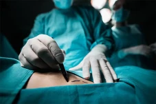 Apa Itu Liposuction,...