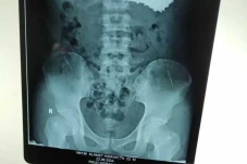 Astaga! Dokter Temukan...