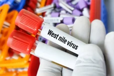Apakah Virus West Nile...