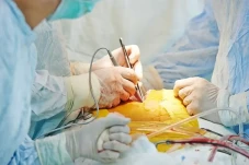 Hukum Transplantasi...
