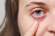 Mengenal Retinopati...
