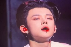 Yeonjun TXT Terluka...