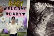 Pamer Foto Ultrasound,...