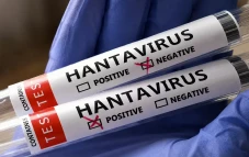 Waspada Hantavirus,...