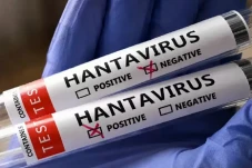 3 Kasus Positif Hantavirus...