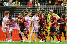 Messi Absen, Inter Miami...