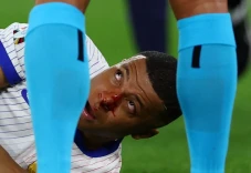 Waduh, Hidung Kylian...