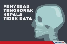 Beberapa Faktor Penyebab...