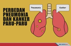 Simak! Ini Perbedaan...
