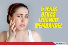 Yuk Simak! Ini 5 Jenis...