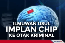 Ilmuwan Usulkan Implan...
