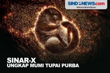 Sinar-X Ungkap Mumi...