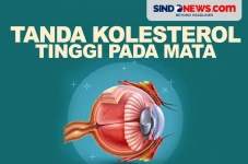 Tanda Gejala Kolesterol...