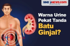 Apakah Warna Urine yang...