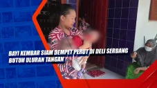 Bayi Kembar Siam Dempet...