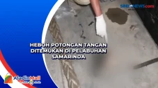 Heboh Potongan Tangan...