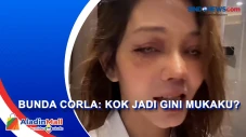 Unggah Foto Wajah Lebam...