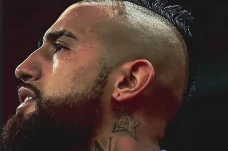 Arturo Vidal Berpisah...